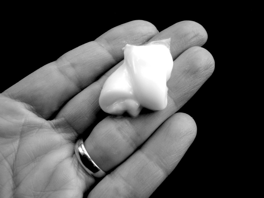 True or False Cocoa butter eliminates stretch marks? Was Mom Wrong?